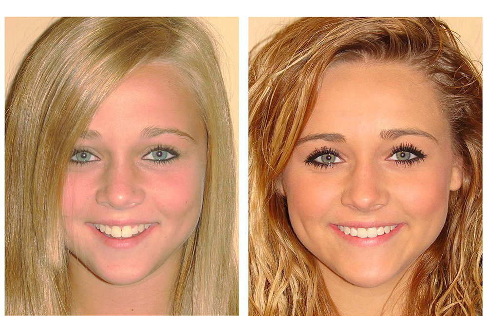 Joseph A. Magotch, DDS