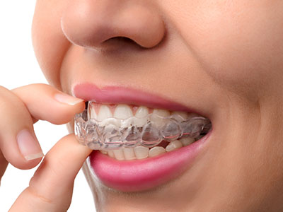 The image shows a person holding a clear dental retainer with their fingers while looking at it intently.