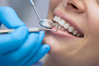 The image shows a dental professional performing a dental procedure on a patient, with a focus on teeth whitening or cleaning, indicated by the presence of a dental drill and toothpaste being applied.