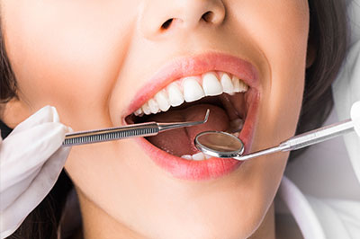 The image shows a person with an open mouth, surrounded by dental instruments, likely in a dental office setting.