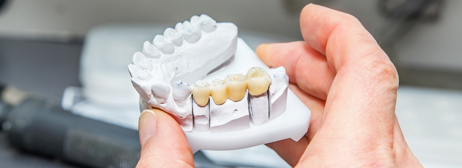 A person's hand holding a clear dental model with teeth, positioned against a blurred background.