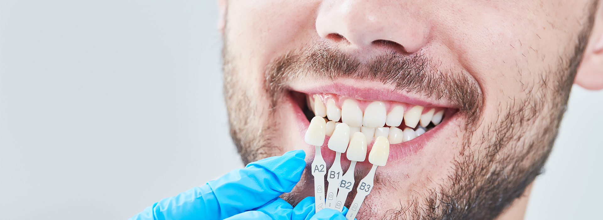 A man with a toothy grin undergoing dental treatment, captured in a close-up shot.